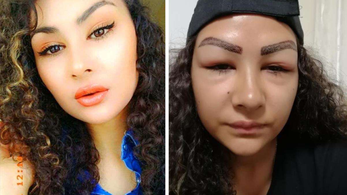 Ailesinden gizli reklam yüzü olmak isteyen 16 yaşındaki kız çocuğu, şimdi aynaya bakamıyor