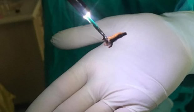 Çiğnediği karanfil ölümüne sebep oluyordu