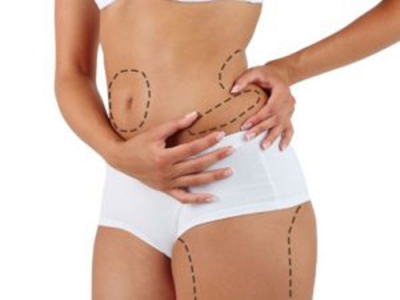 Liposuctıon Fiyatları