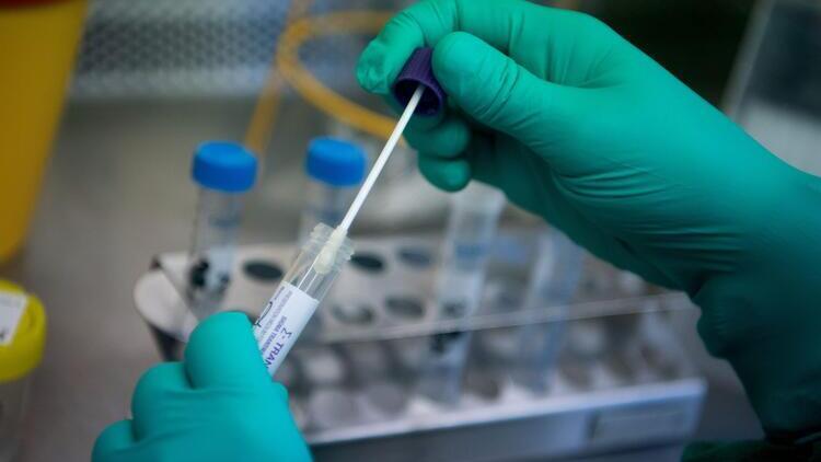 Şanlıurfa İl Sağlık Müdürlüğünden PCR testi açıklaması! 'Sorun giderilmiştir'