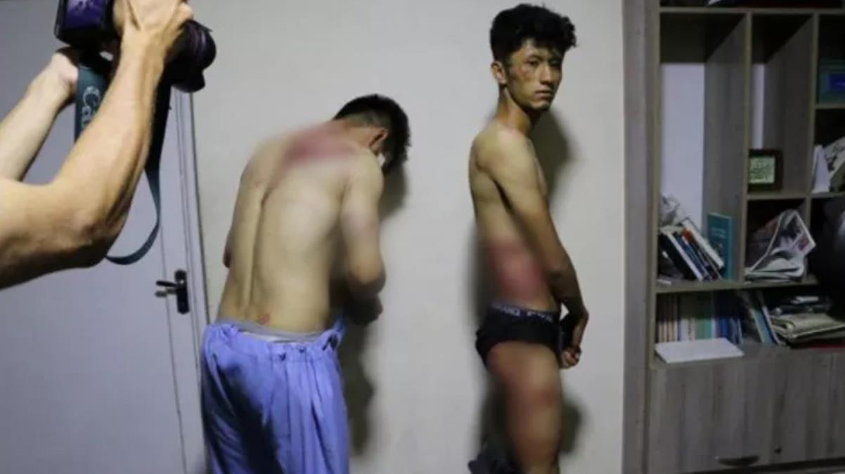 Taliban’dan Afgan gazetecilere 4 saat süren işkence Vücutlarındaki morlukları kameralara gösterdiler