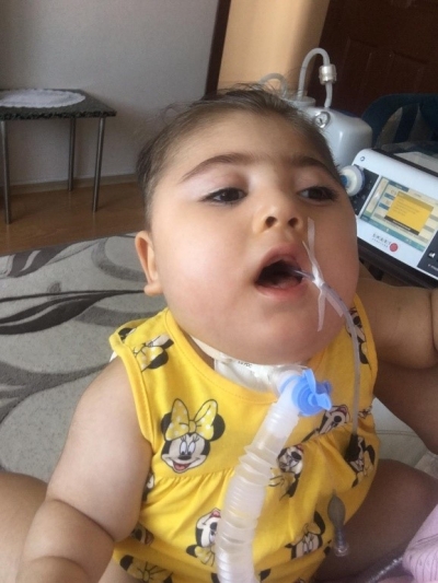UMUDUN ADI POLEN BEBEK DAYAN BAL ARISI